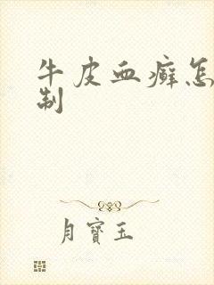 牛皮血癣怎么抑制