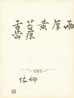 舌苔黄厚两边有齿痕