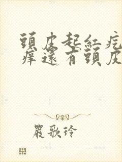 头皮起红疙瘩发痒还有头皮屑