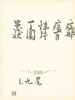 患了性疾病的症状图片有哪些