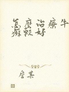 怎么治疗牛皮有癣较好