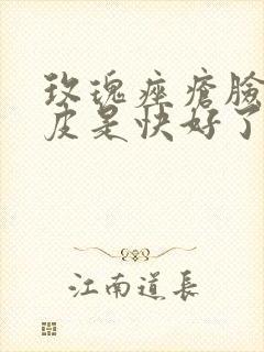 玫瑰痤疮脸上脱皮是快好了吗