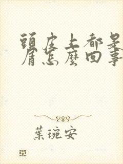 头皮上都是头皮屑怎么回事