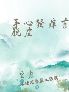 手心发痒有红点脱皮