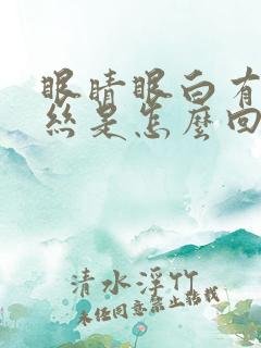 眼睛眼白有红血丝是怎么回事