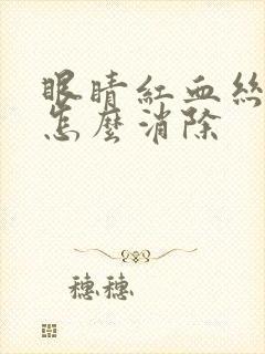 眼睛红血丝明显怎么消除