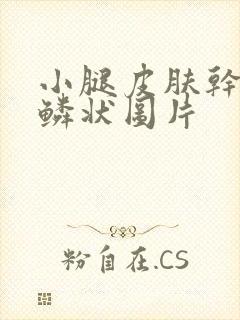 小腿皮肤干燥鱼鳞状图片