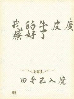 我的牛皮广癣治疗好了