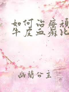 如何治疗顽固性牛皮血癣比较好