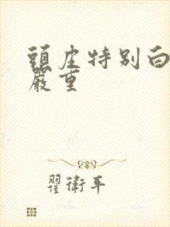 头皮特别白掉发严重