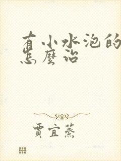 有小水泡的脚气怎么治