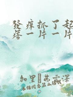 发痒抓了起红疙瘩一片一片的