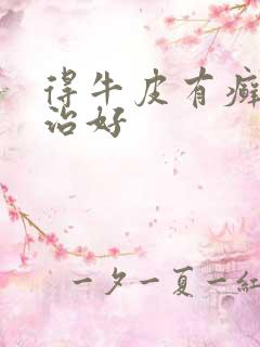 得牛皮有癣如何治好