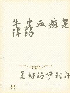 牛皮血癣是怎么得的