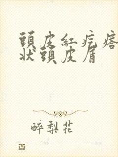 头皮红疙瘩有块状头皮屑