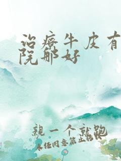 治疗牛皮有癣医院那好