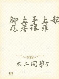 脚上手上起红色疙瘩很痒