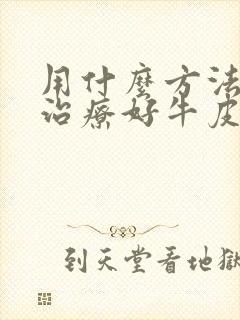 用什么方法可以治疗好牛皮