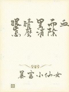 眼睛里面血丝多怎么消除