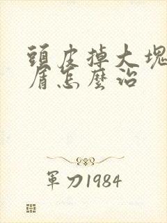 头皮掉大块头皮屑怎么治