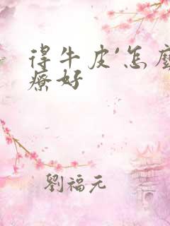 得牛皮`怎么治疗好