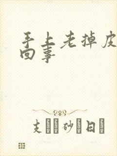 手上老掉皮怎么回事