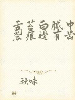 舌苔白腻中间有裂痕边有齿痕