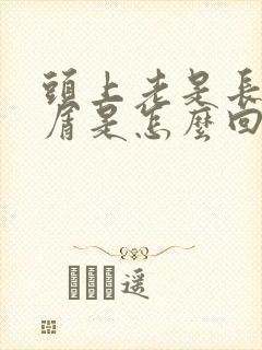 头上老是长头皮屑是怎么回事怎么治