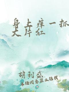 身上痒一抓就起大片红