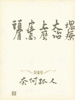 头皮上大块头皮屑怎么治疗