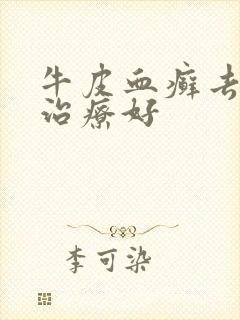 牛皮血癣去哪里治疗好