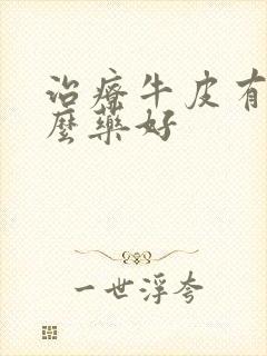 治疗牛皮有癣什么药好