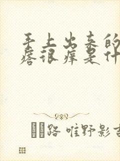 手上出来的小疙瘩很痒是什么病