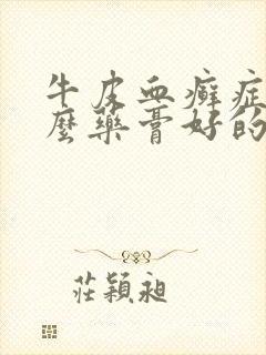 牛皮血癣症用什么药膏好的快