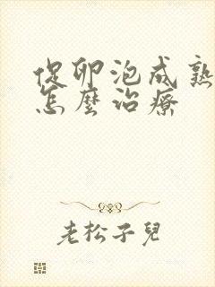 促卵泡成熟素高怎么治疗