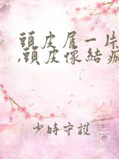 头皮屑一片片的,头皮像结痂了一样