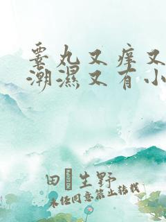 睾丸又痒又疼又潮湿又有小红疙瘩