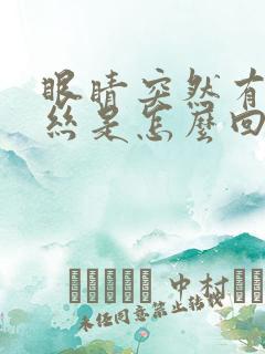 眼睛突然有红血丝是怎么回事