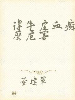 得牛皮血癣有什么危害