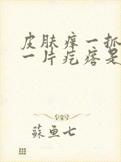 皮肤痒一抓就起一片疙瘩是怎么回事