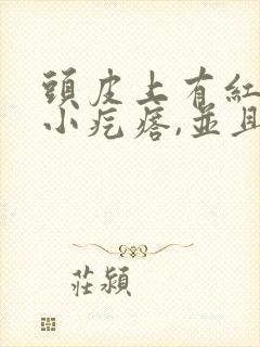 头皮上有红色的小疙瘩,并且有头皮屑