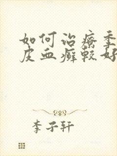 如何治疗季节牛皮血癣较好