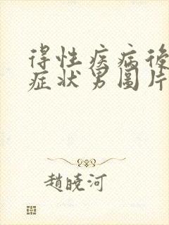 得性疾病后八大症状男图片