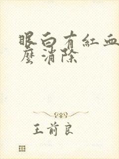 眼白有红血丝怎么消除