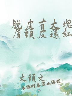 脱皮有大块头皮屑头皮还红红的怎么会事