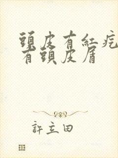 头皮有红疙瘩还有头皮屑