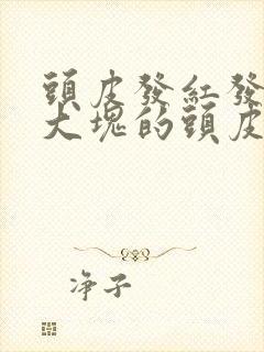 头皮发红发痒有大块的头皮屑是怎么回事