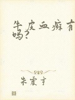 牛皮血癣有得治吗?