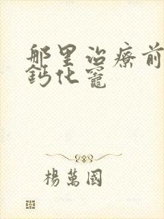 那里治疗前列腺钙化灶