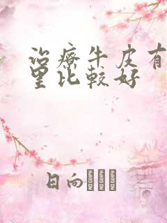 治疗牛皮有癣哪里比较好